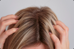 Proteja seu cabelo da água dura com as estratégias do Laces. Tratamentos naturais e hidrominerais que eliminam minerais e trazem de volta o seu brilho puro.