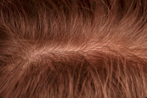 Microbioma Capilar Saudável, Couro cabeludo equilibrado, Chave Laces microbiota, Skinificação couro cabeludo, Prebióticos probióticos cabelo, Caspa tratamento natural, Queda de cabelo tratamento, Laces and Hair, Cosméticos naturais sustentáveis, Flora capilar homeostase